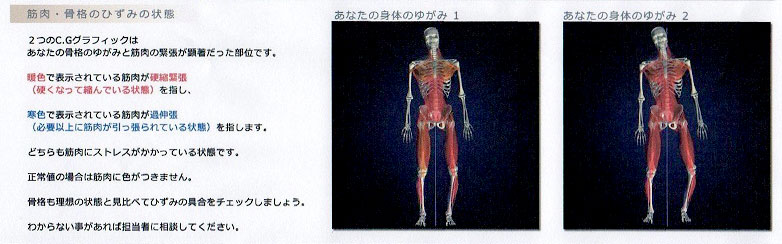 3.筋肉・骨格のひずみについて